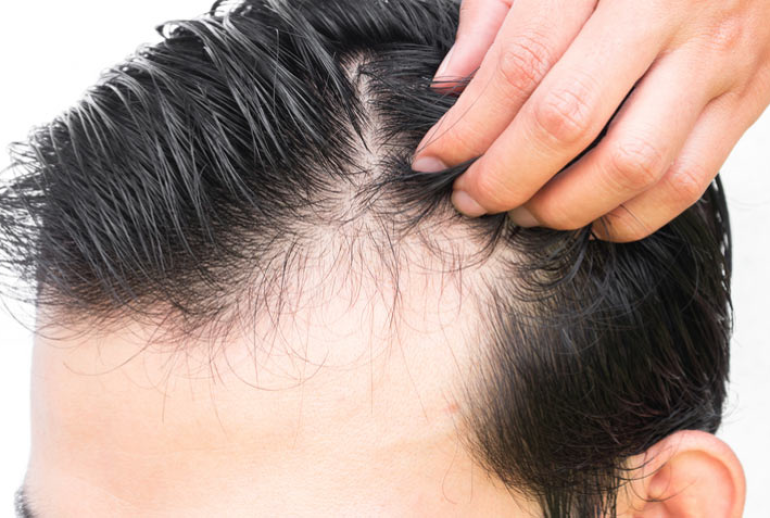 ۱۷۳۹۳۴۷۱۸۳.542291_594010_image 1739347183.542291_594010_image