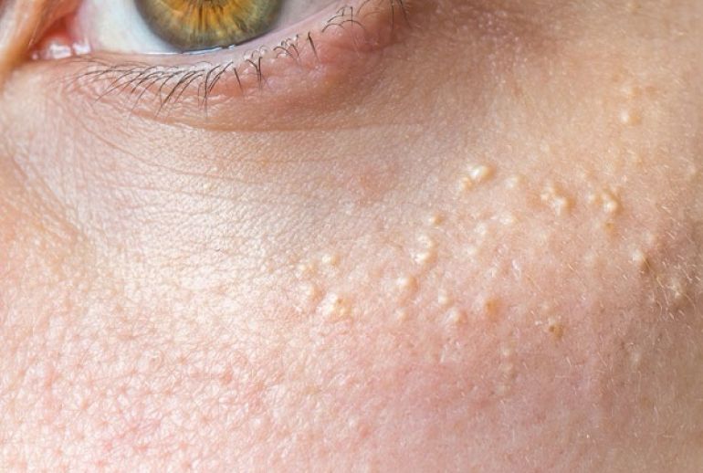 ۱۷۳۹۳۴۷۱۹۴.379122_550794_image 1739347194.379122_550794_image