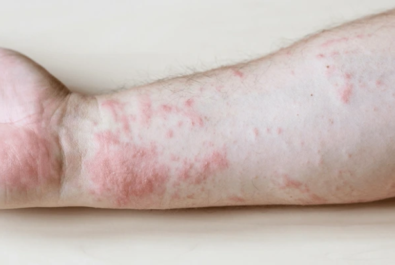 ۱۷۳۹۳۴۷۲۲۸.511932_810375_image 1739347228.511932_810375_image